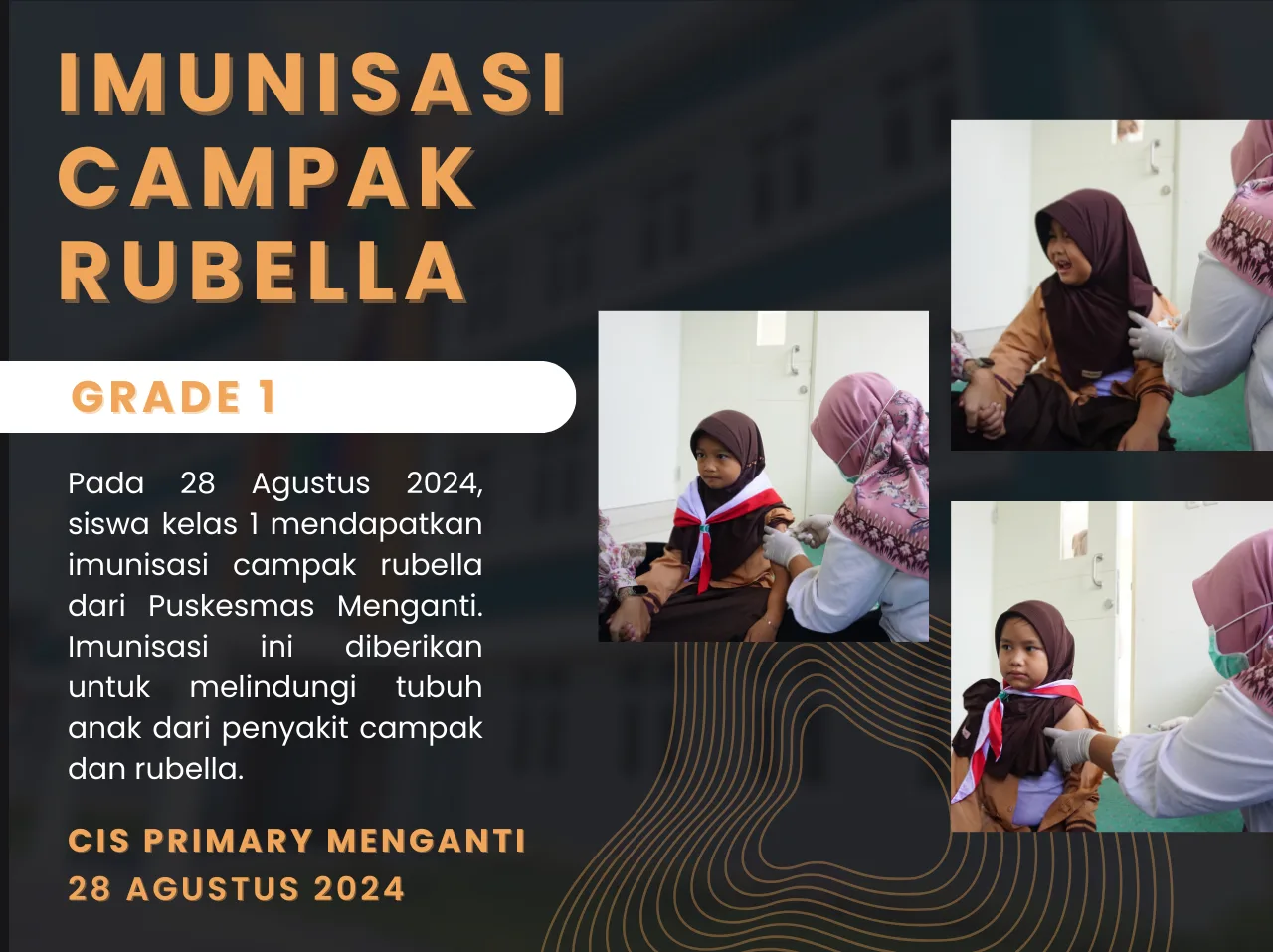 Measles-Rubella Vaccination for Grade 1
